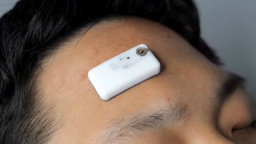 This patch unobtrusively monitors brain health (Photo Credit: J. Kwon et al.)