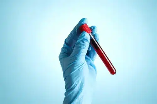 Microwave Metamaterial Biosensor Shows Promise for Label-Free Blood Analysis