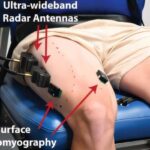 New Sensor Tracks Muscle Force Without Surgery