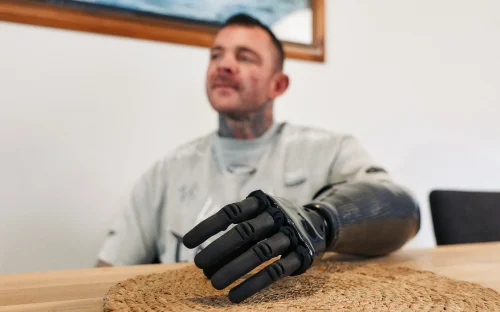 Close-up of a black robotic prosthetic hand resting on a table, with a person visible out of focus in the background